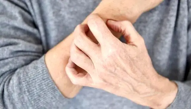 خطاهای رایج پوستی در هوای سرد