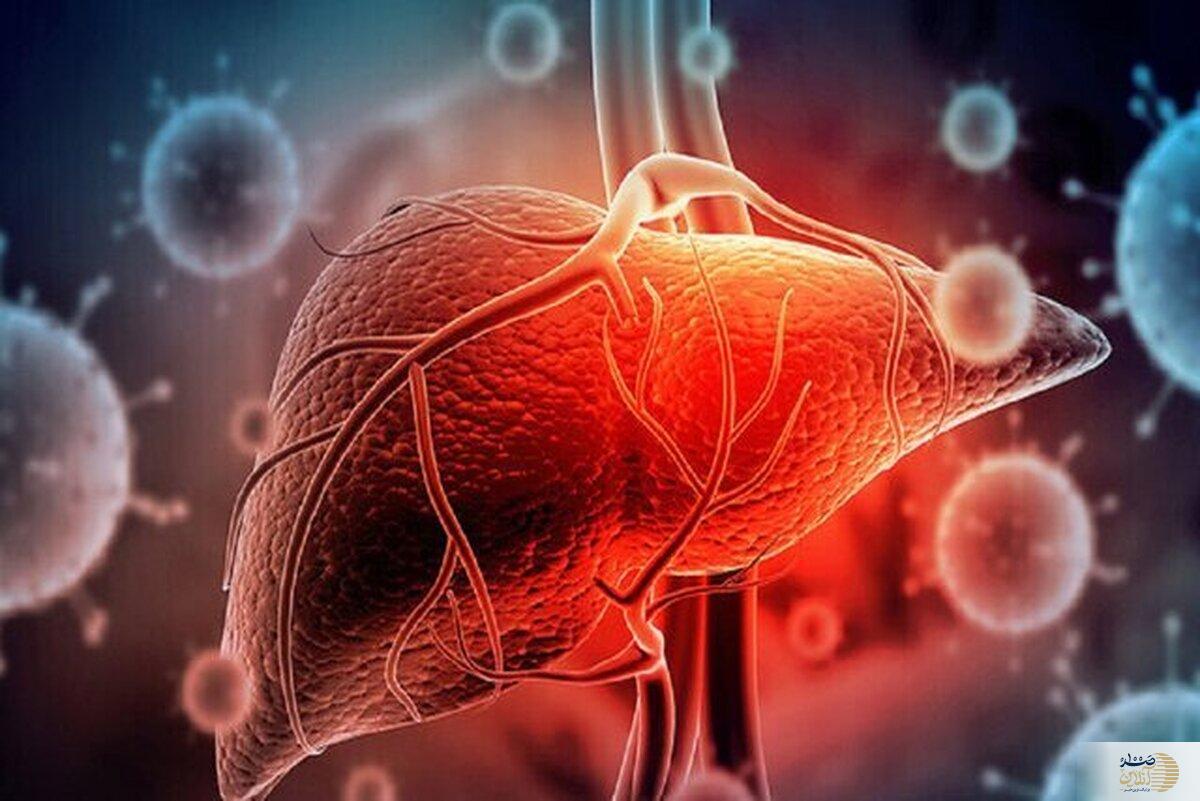کبد چرب را بدون دارو درمان کنید